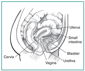 prolapsed bladder repair