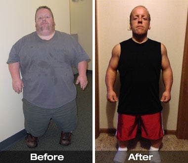 male gastric bypass before and after